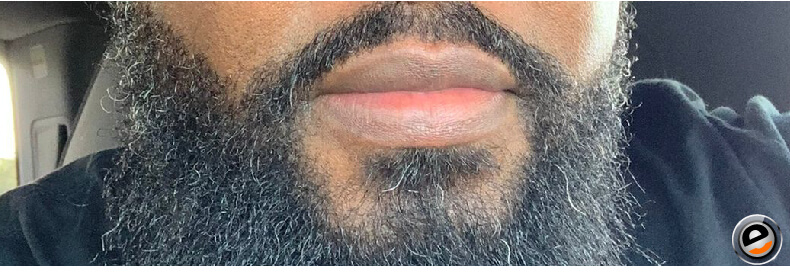 Growing a Beard For Health Benefits